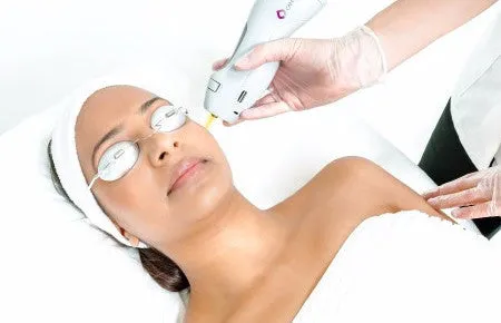Laser Hair Removal: Full Face